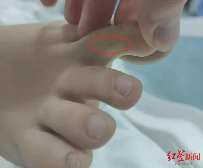 “27岁女子三亚旅游疑被不明物咬伤身亡”家属：事发夜晚天黑看